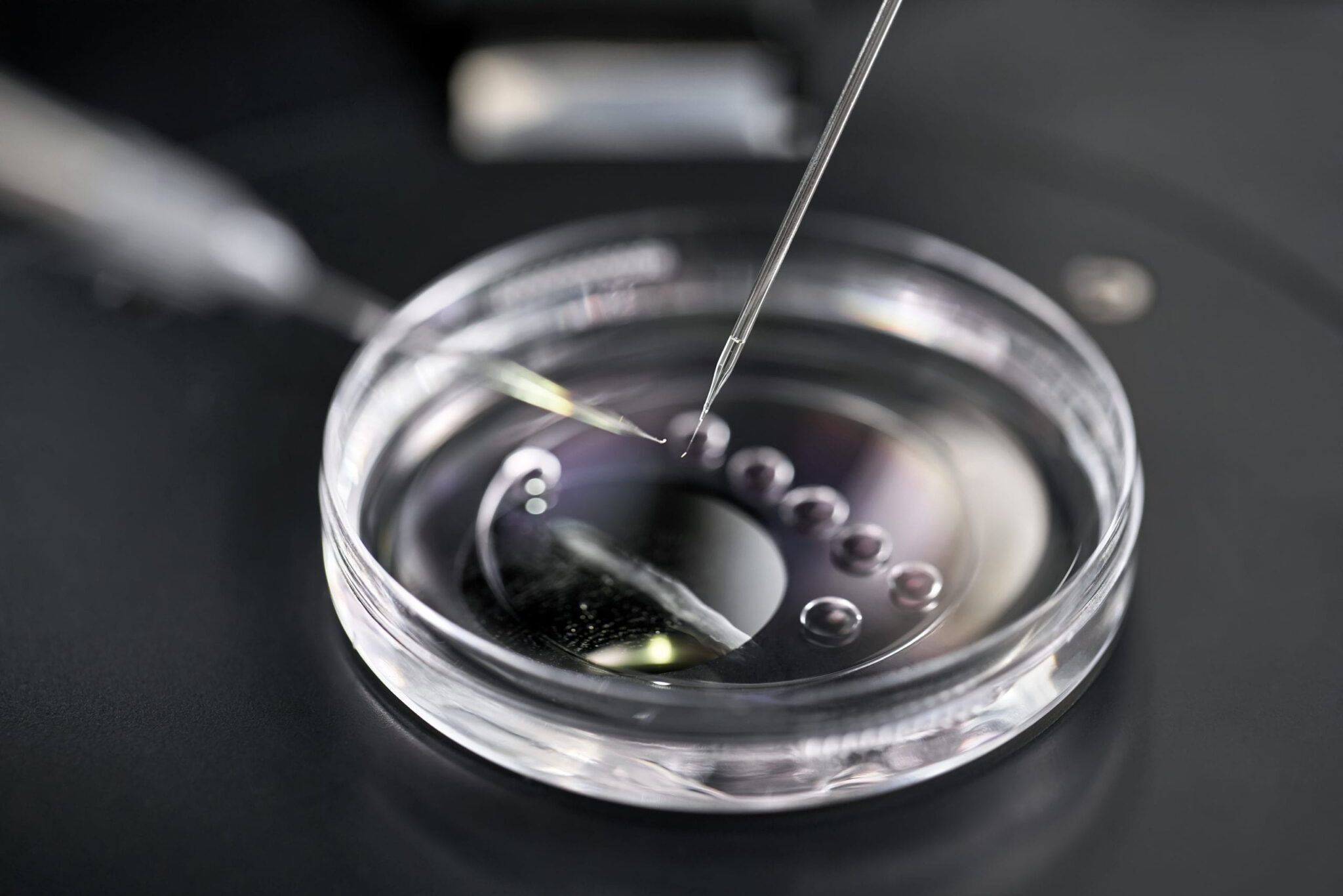 IVF With Donor Sperm CRGH Fertility Treatments