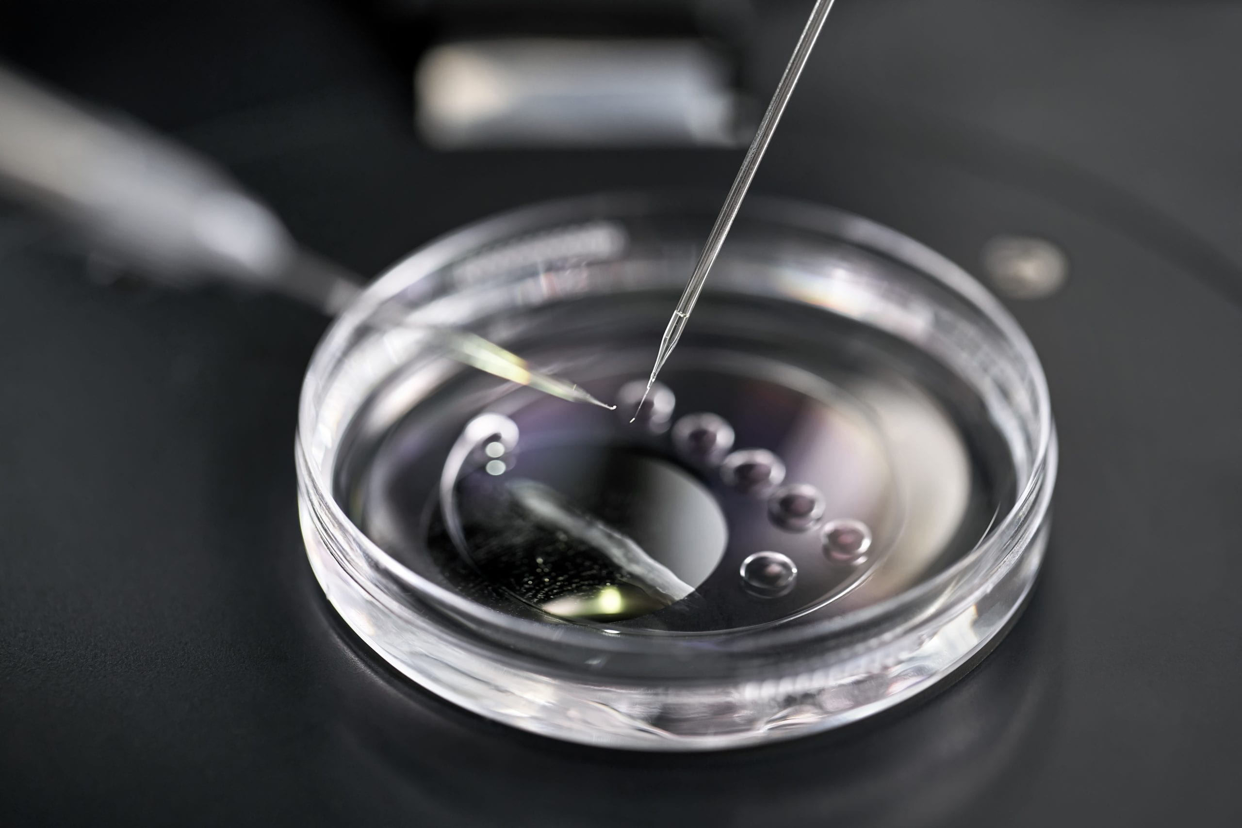 IVF donor sperm being placed into a petri dish.