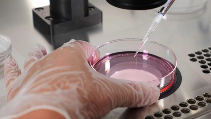 A close up of an embryologist using a pippette to draw pink fluid from a petri dish during an IVF treatment.